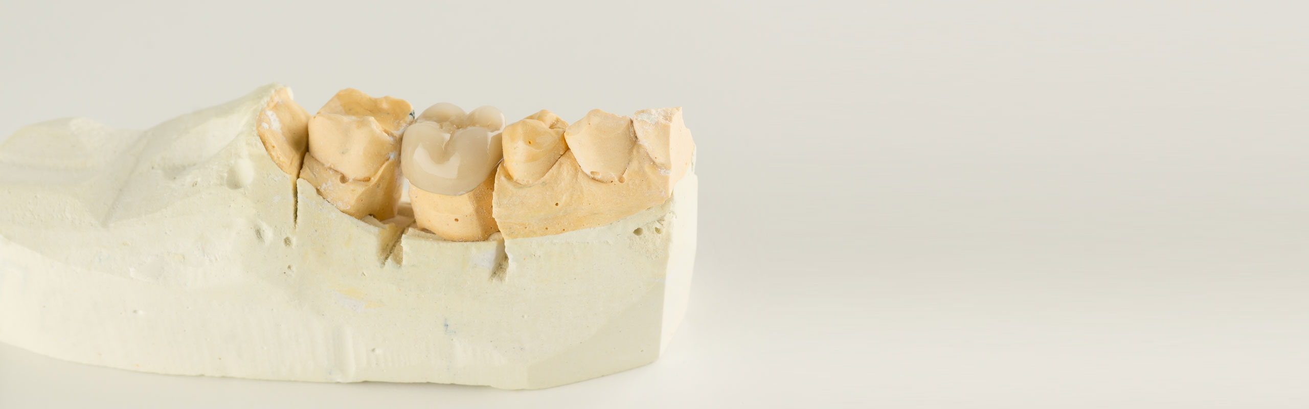 InstaGallery Elite Dental Lab